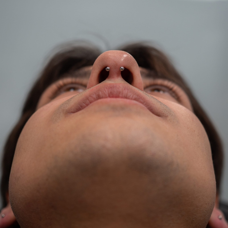 3 septum.JPG